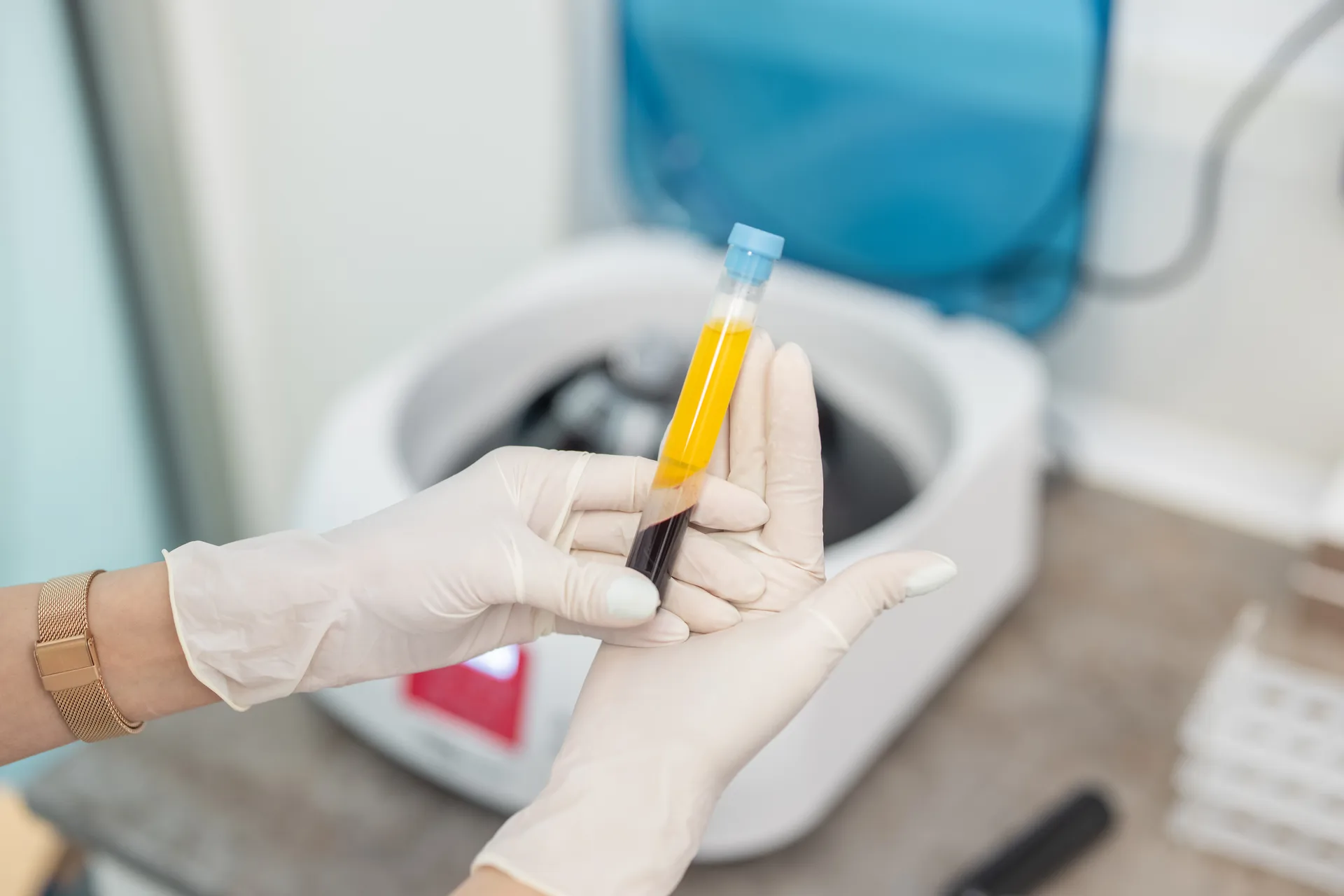 What sets Sanara Medicine apart for PRP & Regenerative Medicine in Lodi, CA