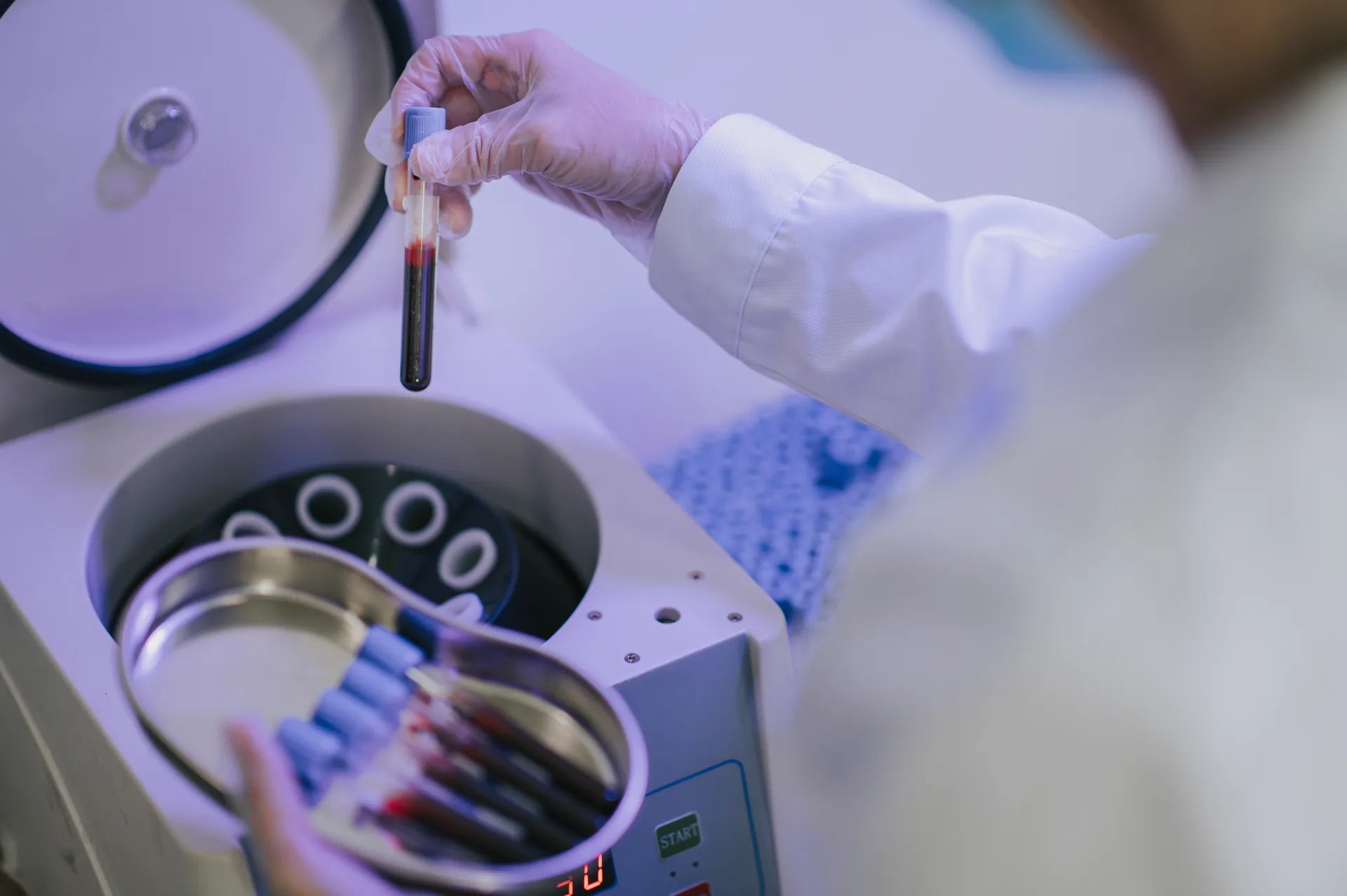 PRP & Regenerative Medicine in Lodi, CA